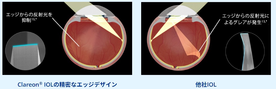 クラレオン ビビティ（Clareon® Vivity®）の安定性