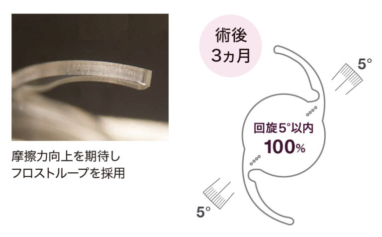 優れた乱視矯正