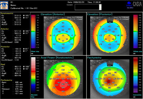 当院の精密な術前検査