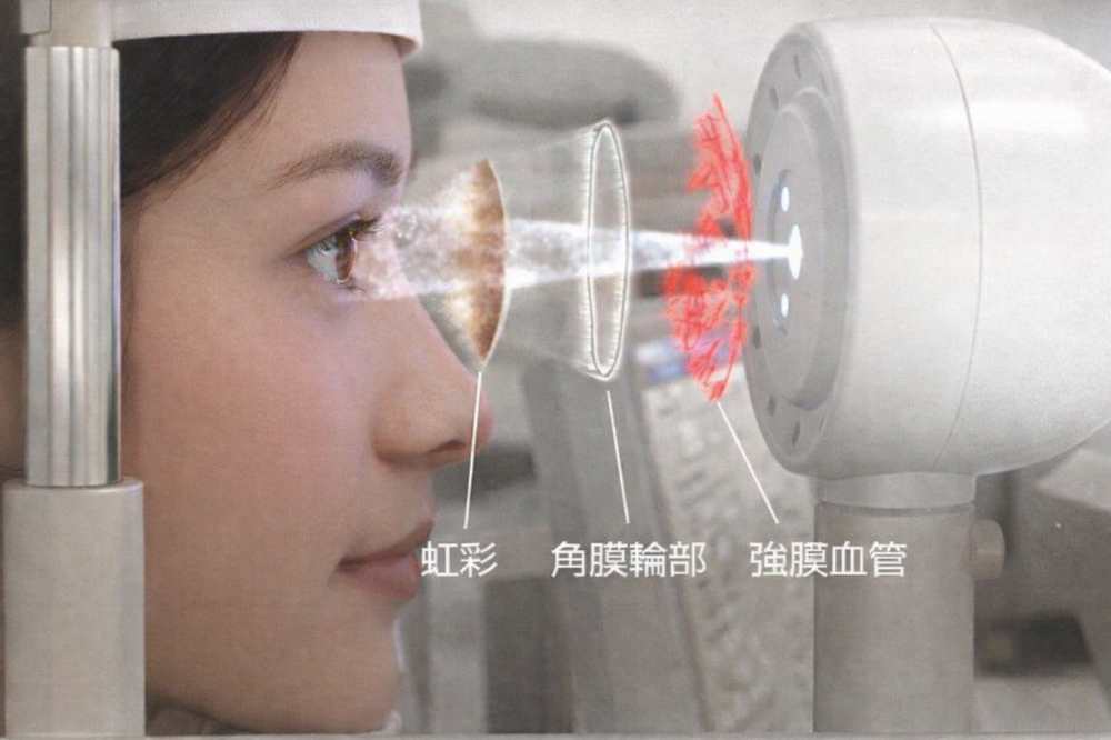 ① 計測：VERION アナライザー