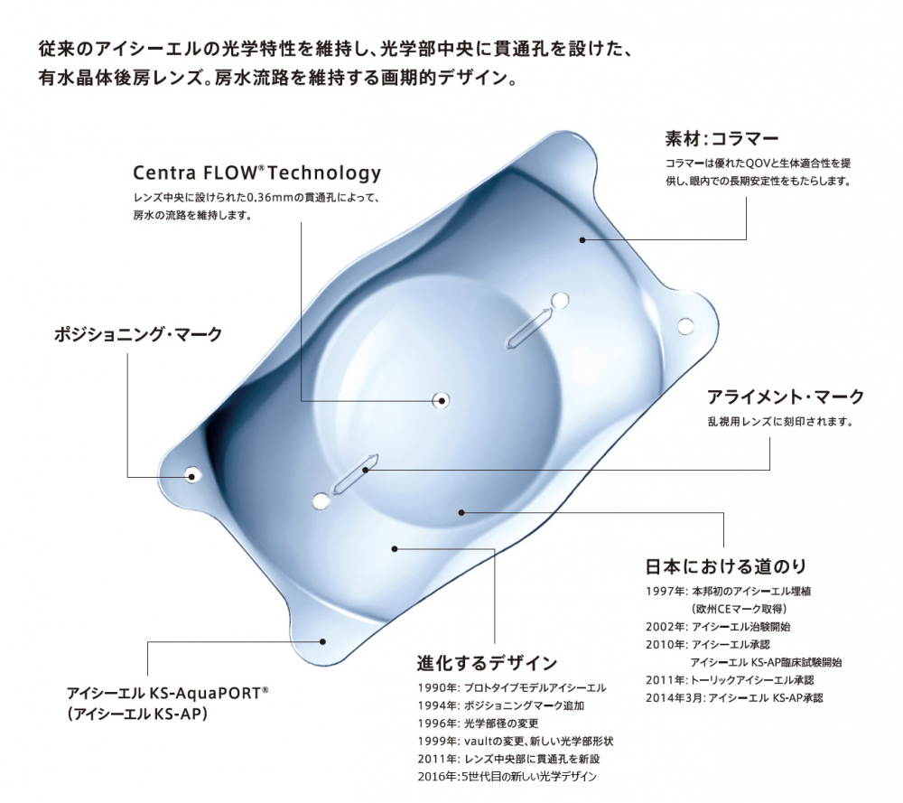 トーリックICL(乱視矯正眼内コンタクト)とは？