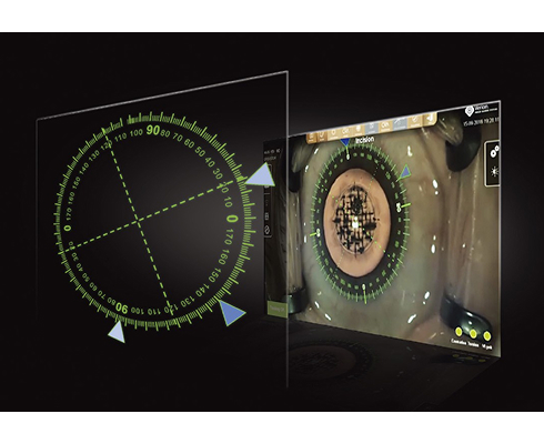 手術ガイドシステム「VERION（ベリオン）」とは