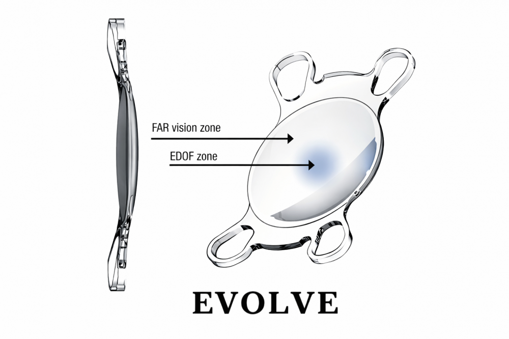 EVOLVE（エボルブ）の見え方の特徴