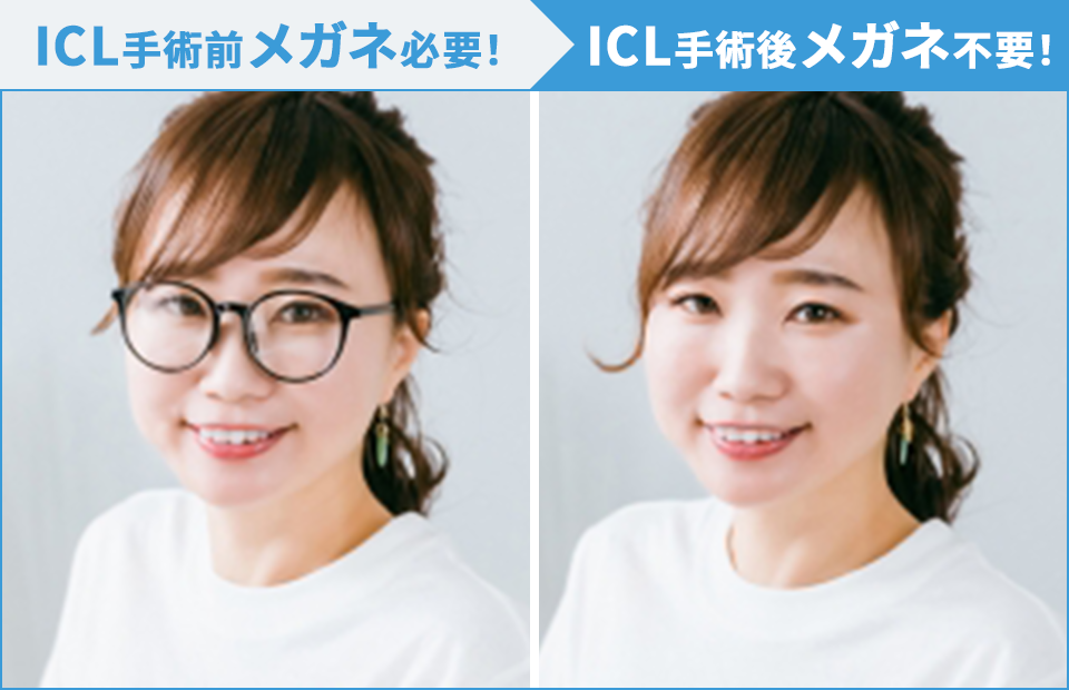 ICL　手術前の眼/手術後の眼